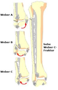 Sprunggelenk - Orthopädie & Unfallchirurgie